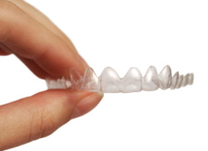Clear Braces